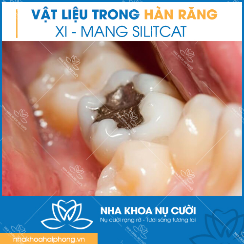cac-loai-vat-lieu-dung-trong-han-rang