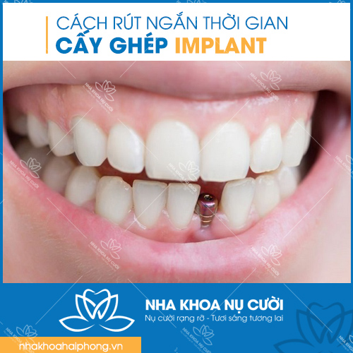 CAY-GHEP