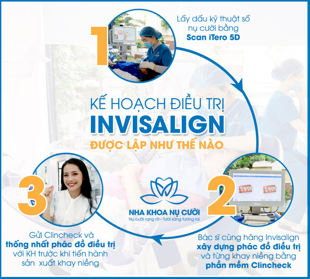 invisalign