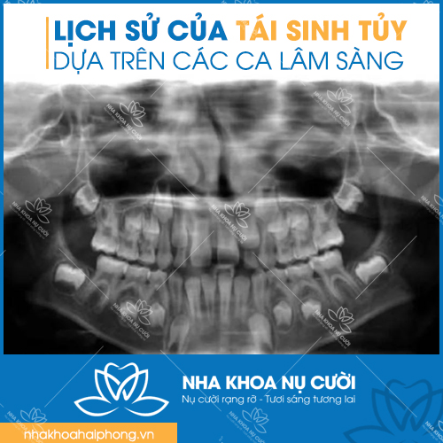 LICH-SU