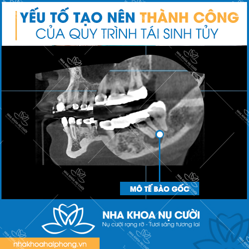 phuong-phap-tai-sinh-mach-mau-tuy-rang