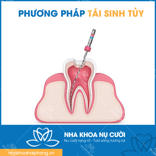 TAI-SINH-TUY