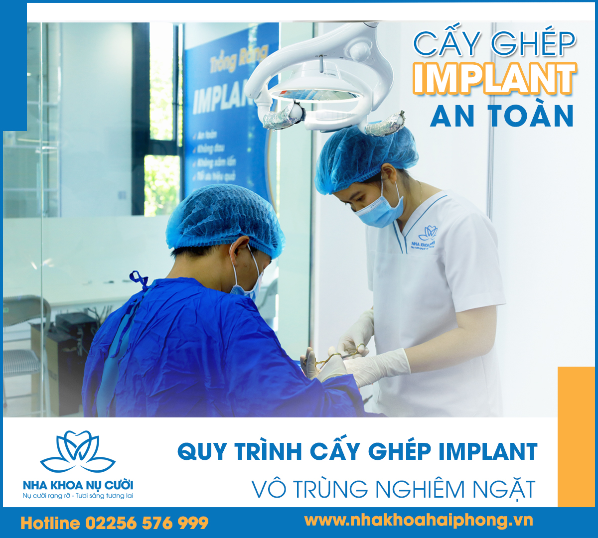 cay-ghep-implant-o-dau-tot-nhat-hai-phong