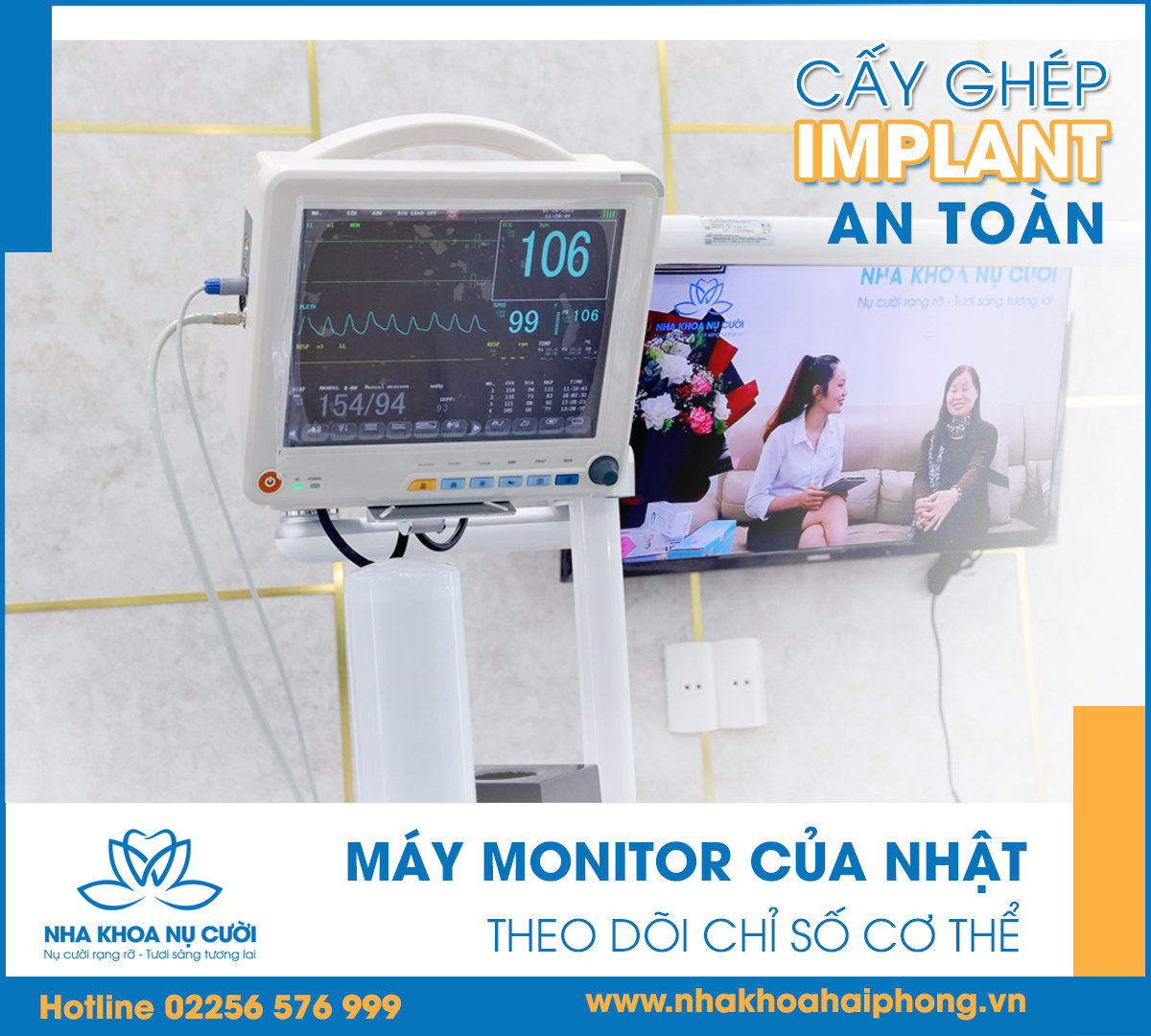 cay-ghep-implant-o-dau-tot-nhat-hai-phong