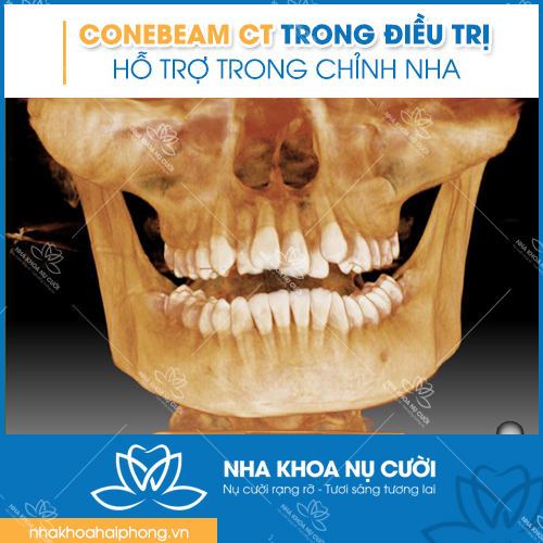 ho-tro-trong-nha-khoa