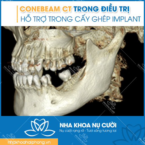 ho-tro-trong-nha-khoa