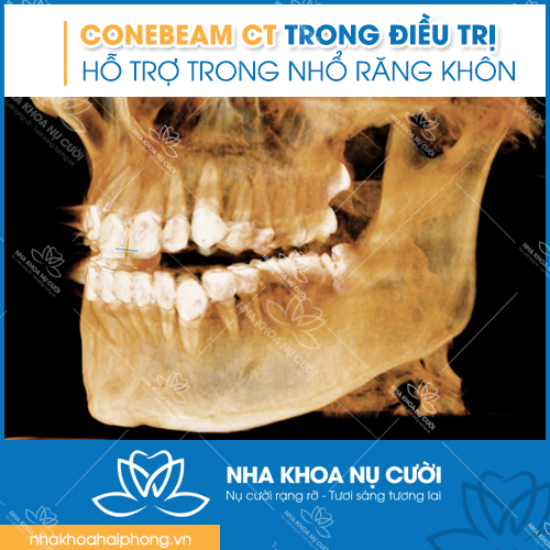 ho-tro-trong-nha-khoa