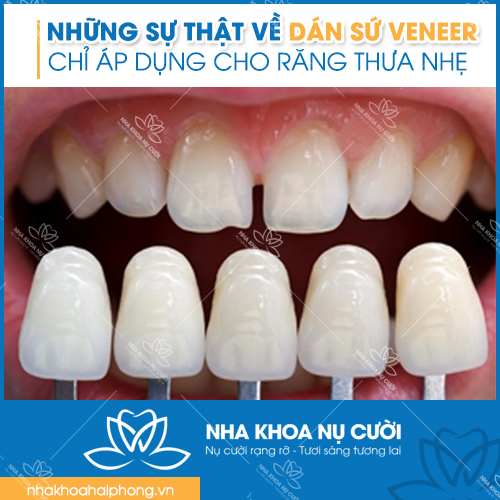ap-dung-cho-rang-thua