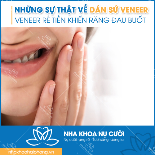 su-that-nen-biet-ve-dan-su-veneer