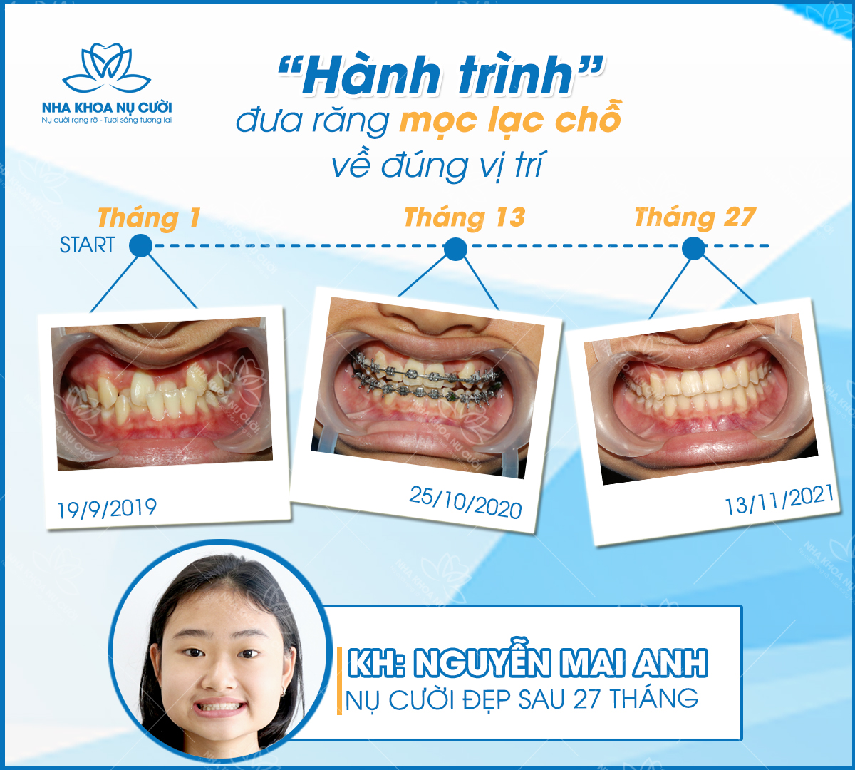 uu-dai-thang-2