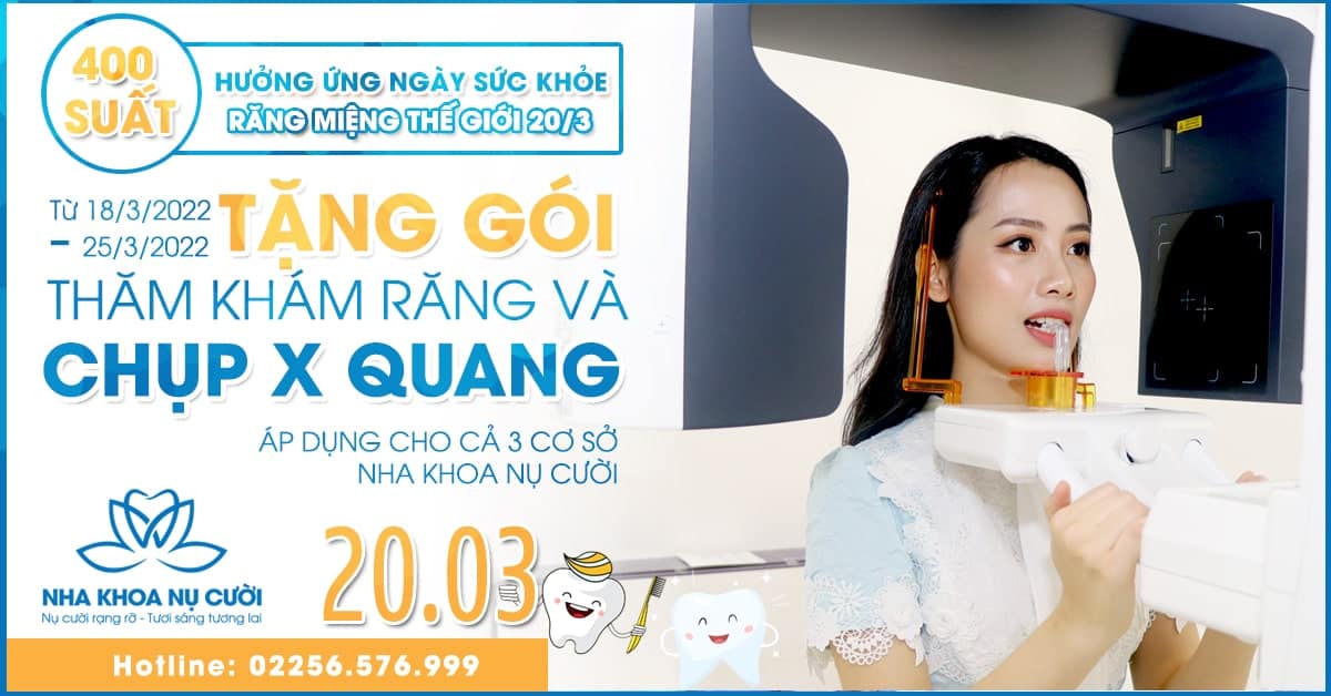 x-quang