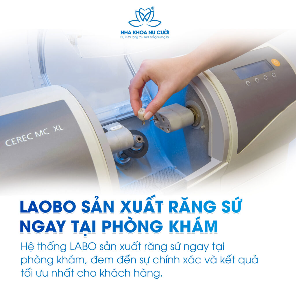 Labo sản xuất răng sứ ngay tại phòng khám
