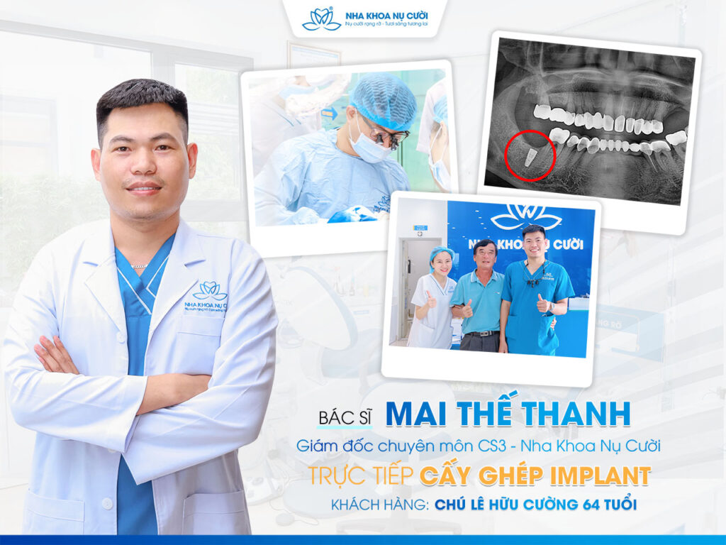 (Khách hàng cấy ghép Implant tại Trung tâm Nha Khoa Nụ Cười)