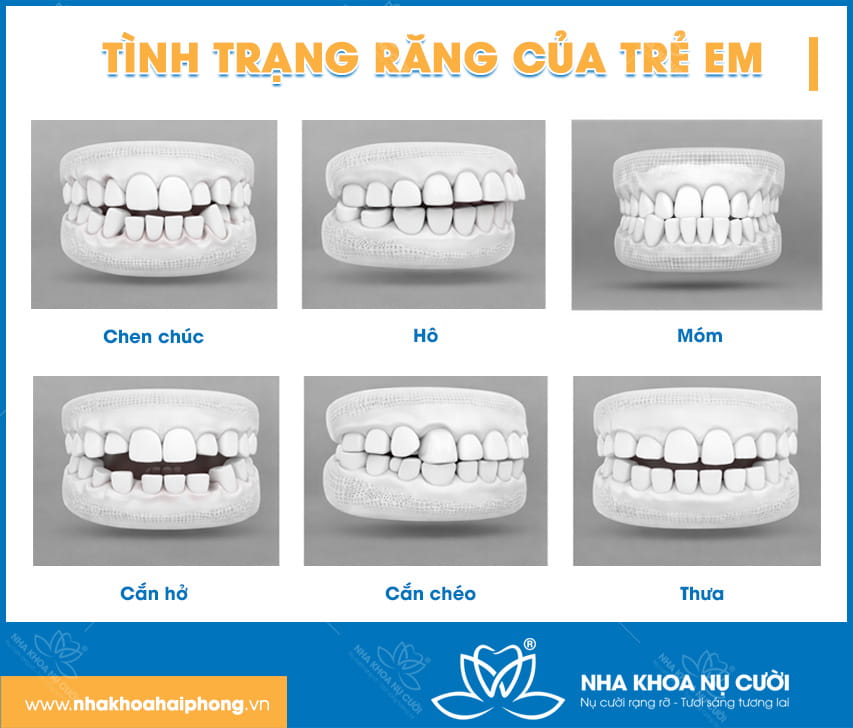 Tinh-trang