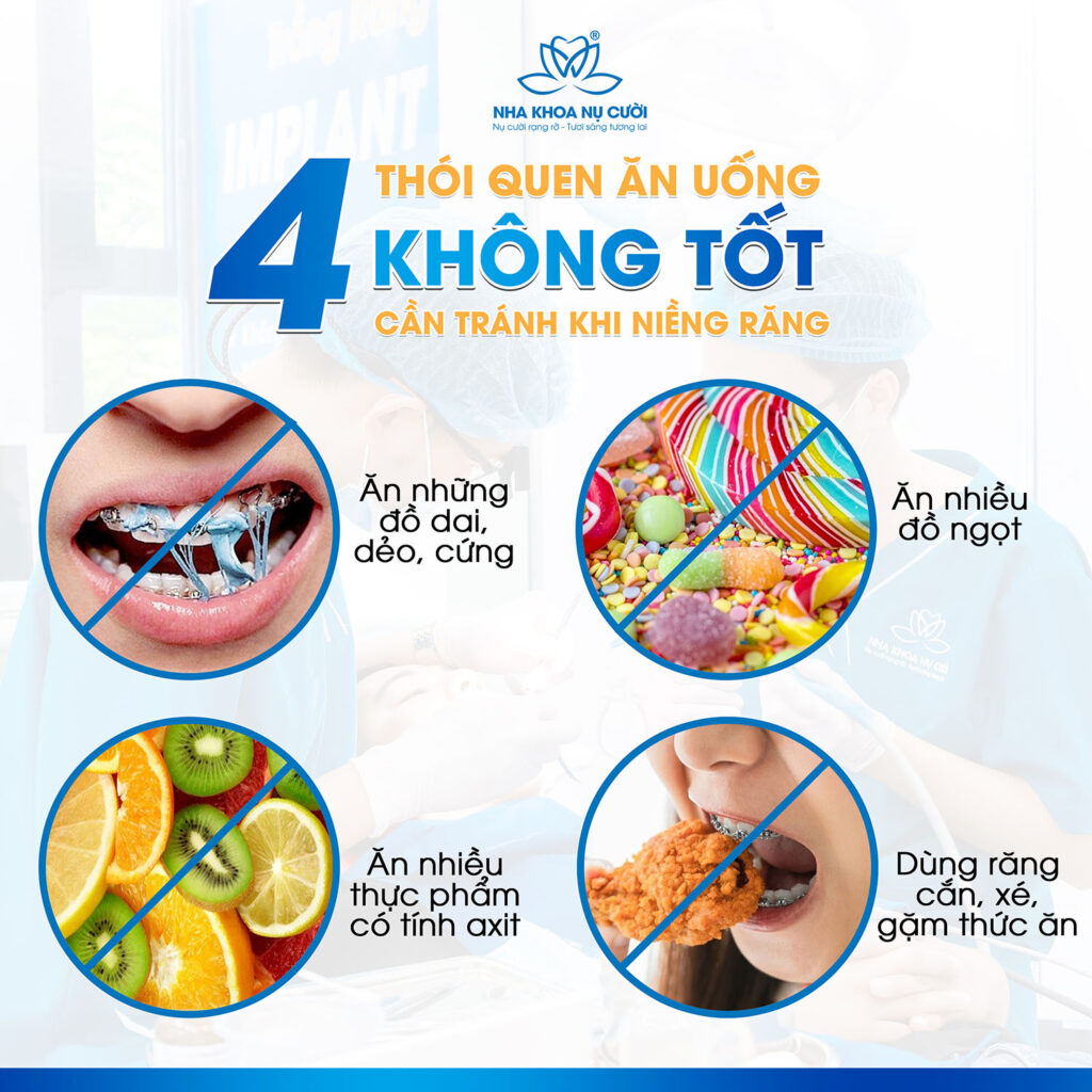 4 THÓI QUEN ĂN UỐNG KHÔNG TỐT CẦN TRÁNH KHI NIỀNG RĂNG