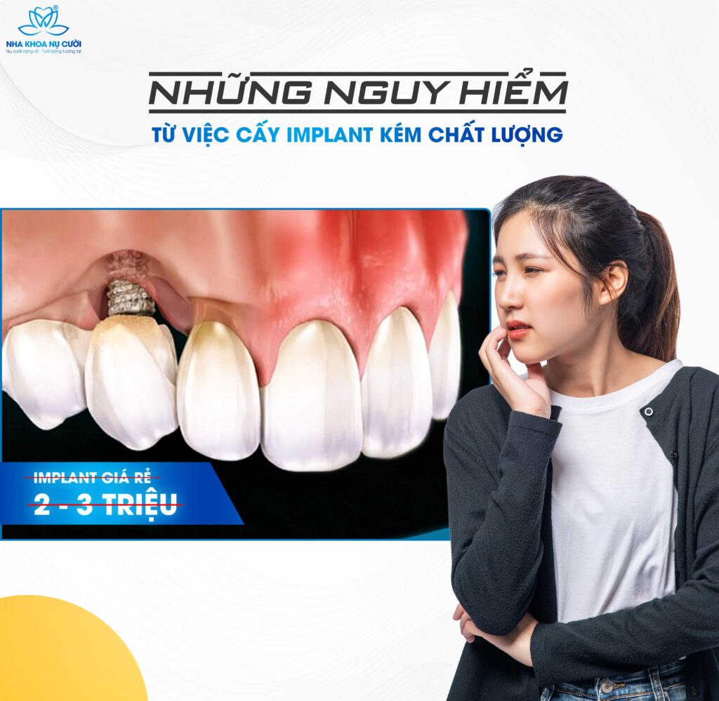 NGUY HIỂM TIỀM ẨN KHI TRỒNG RĂNG IMPALNT GIÁ RẺ