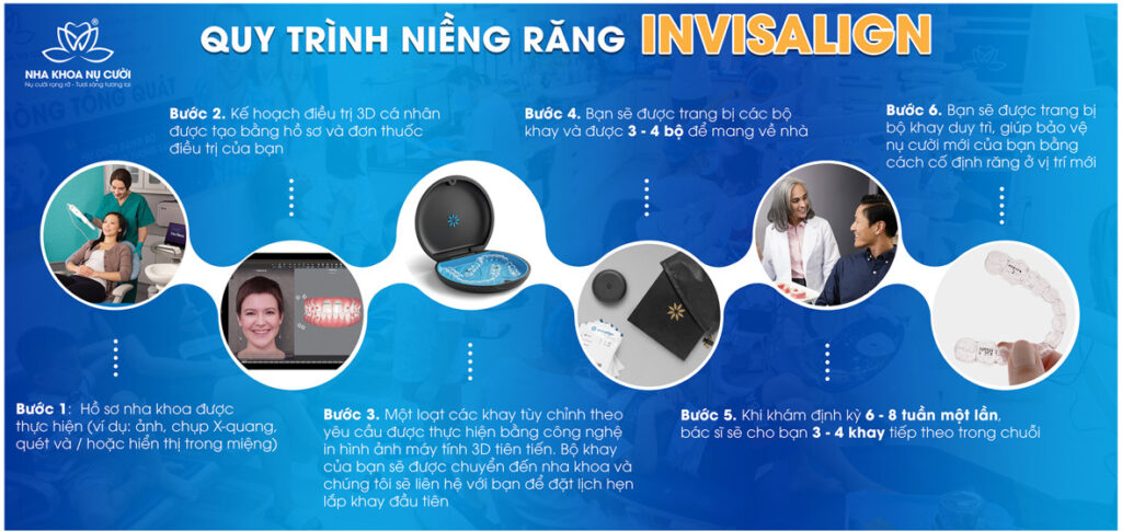 QUY TRÌNH NIỀNG RĂNG INVISALIGN 