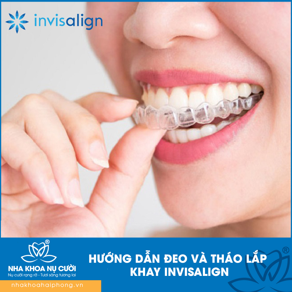 HƯỚNG DẪN ĐEO VÀ THÁO LẮP KHAY INVISALIGN