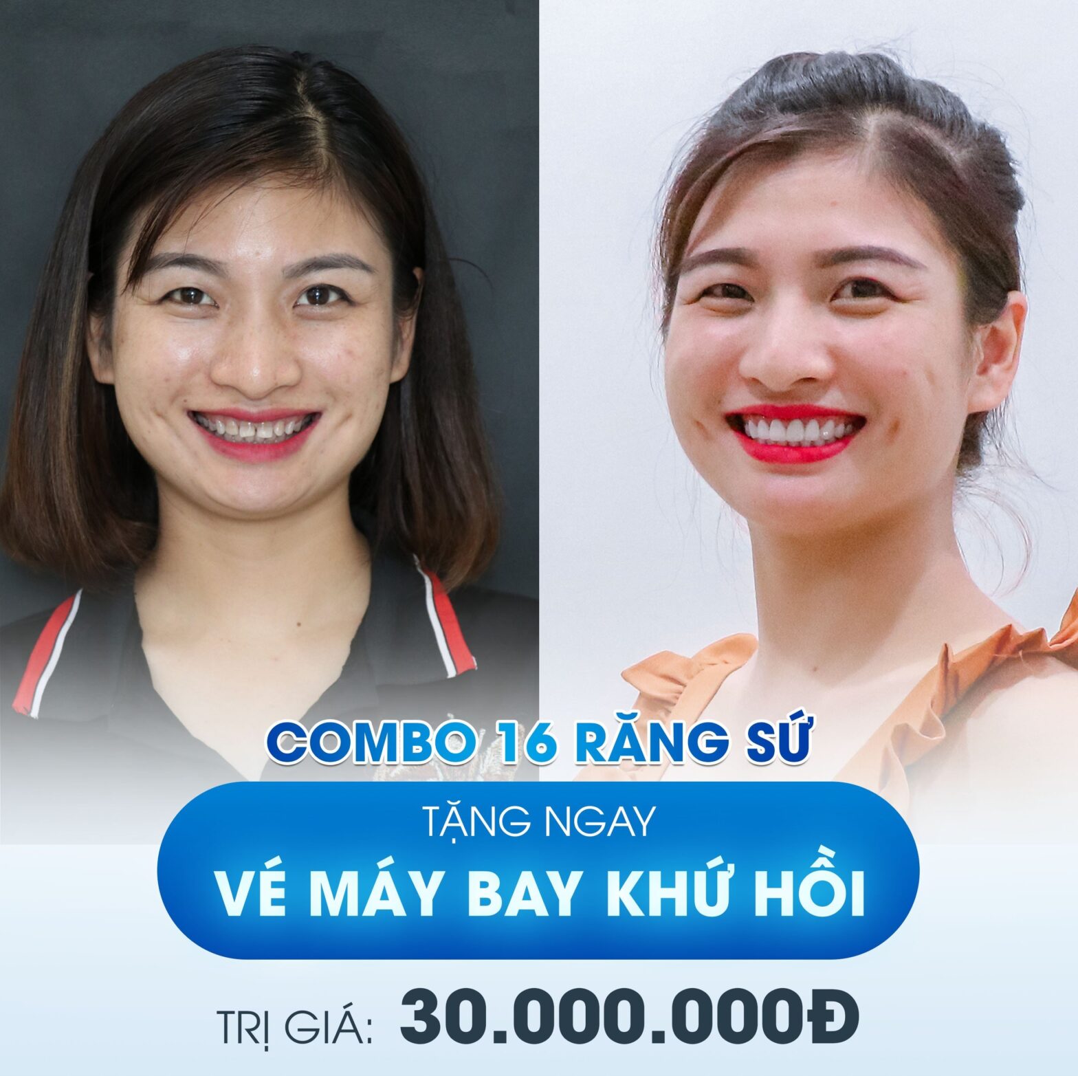 Tặng Vé Khứ Hồi Cho Việt Kiều Úc Làm Răng.