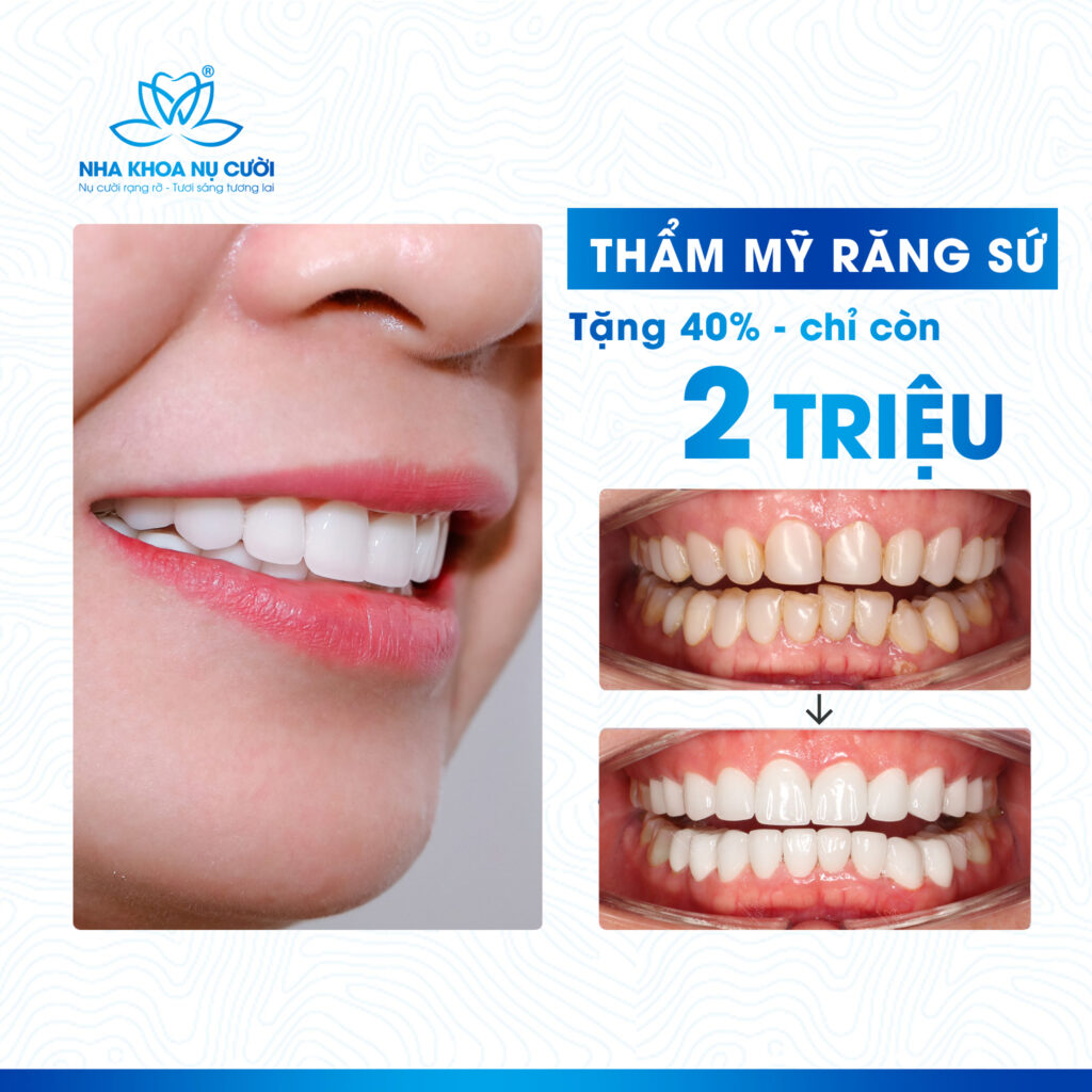 Ưu Đãi Hấp Dẫn Giảm 50% Thẩm mỹ