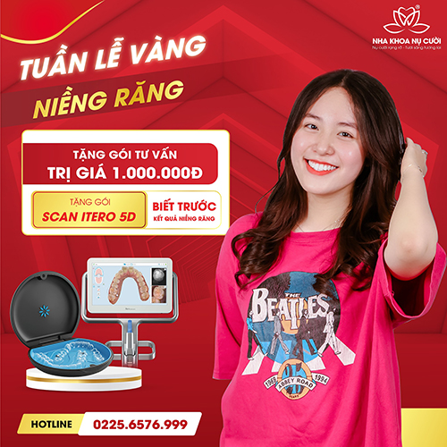 TUẦN LỄ VÀNG NIỀNG RĂNG ÁP DỤNG TỪ NGÀY 22-26/4