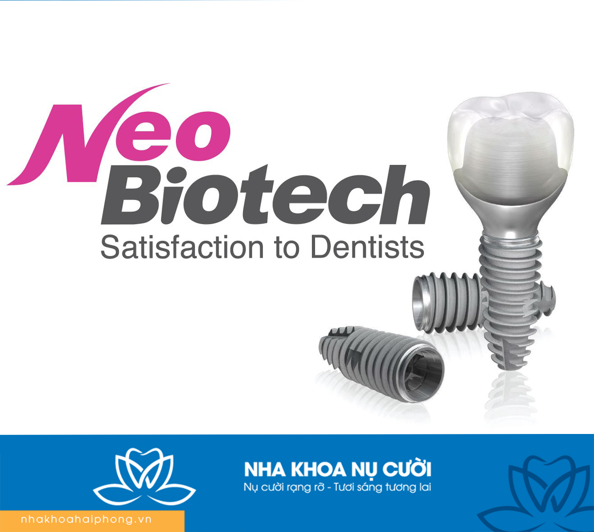 Implant Neobiotech – Giải Pháp Cấy Ghép Răng Tiên Tiến, Bền Vững