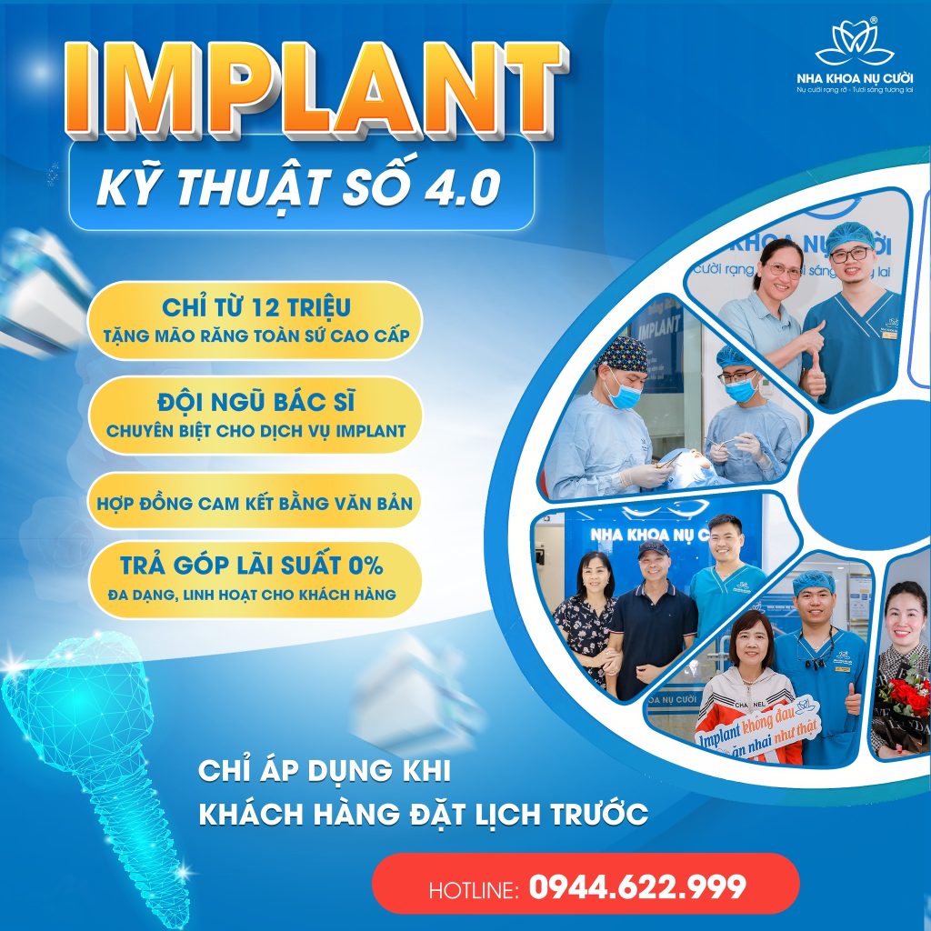 thoi-gian-nao-phu-hop-de-cay-ghep-Implant