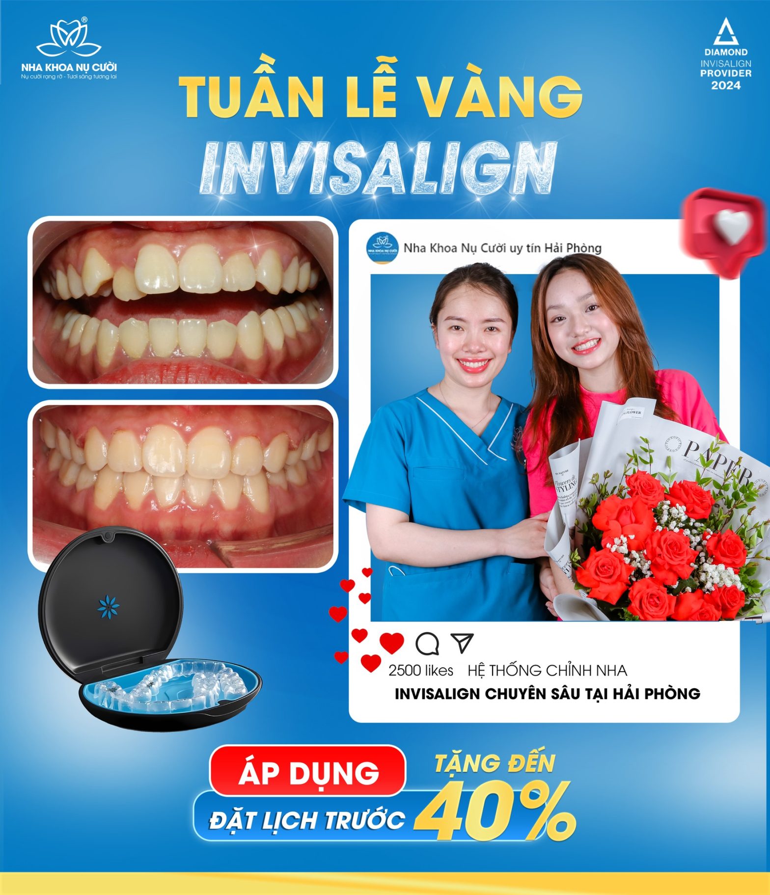 TUẦN LỄ VÀNG – NIỀNG RĂNG INVISALIGN – TẶNG ĐẾN 40%