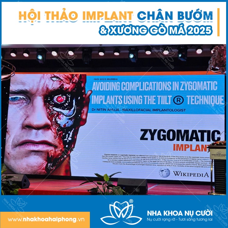 hoi-thao-Impalnt-canh-buom