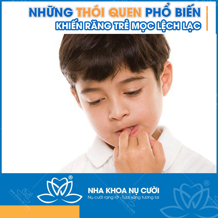 thoi-quen-rang-moc-lech-lac