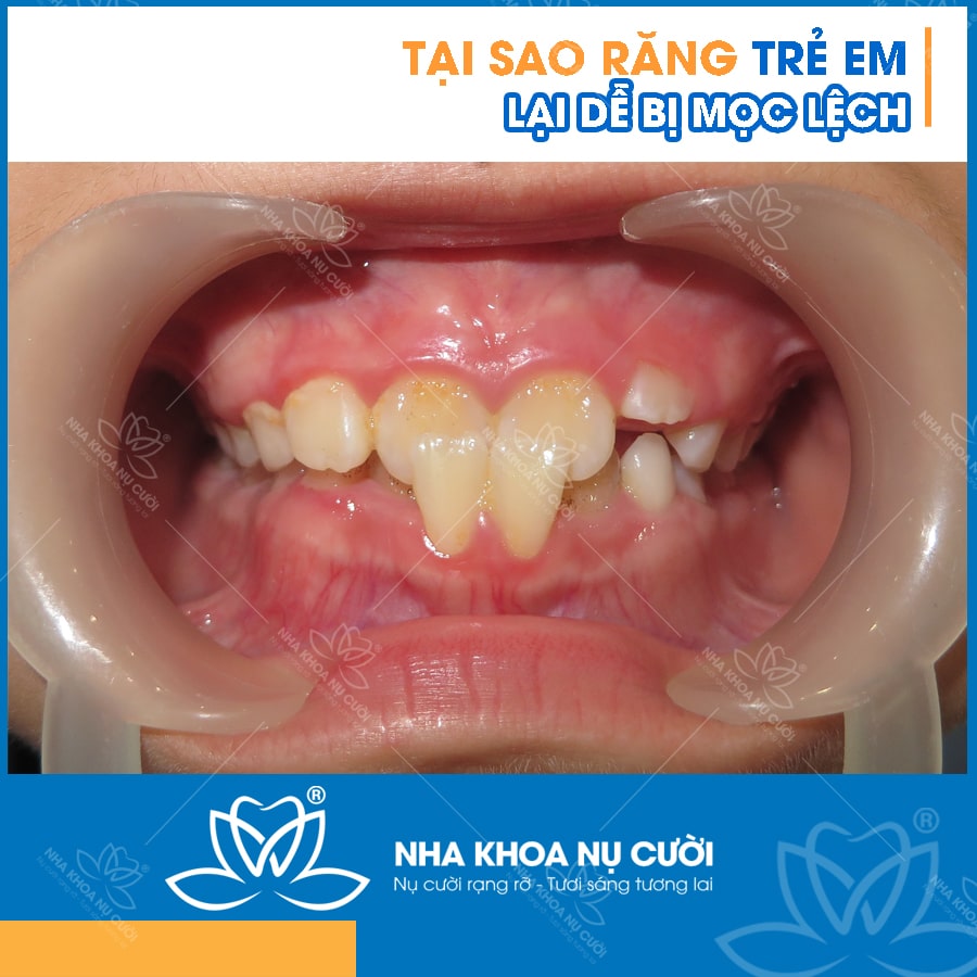 rang-tre-em
