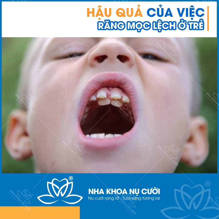 hau-qua