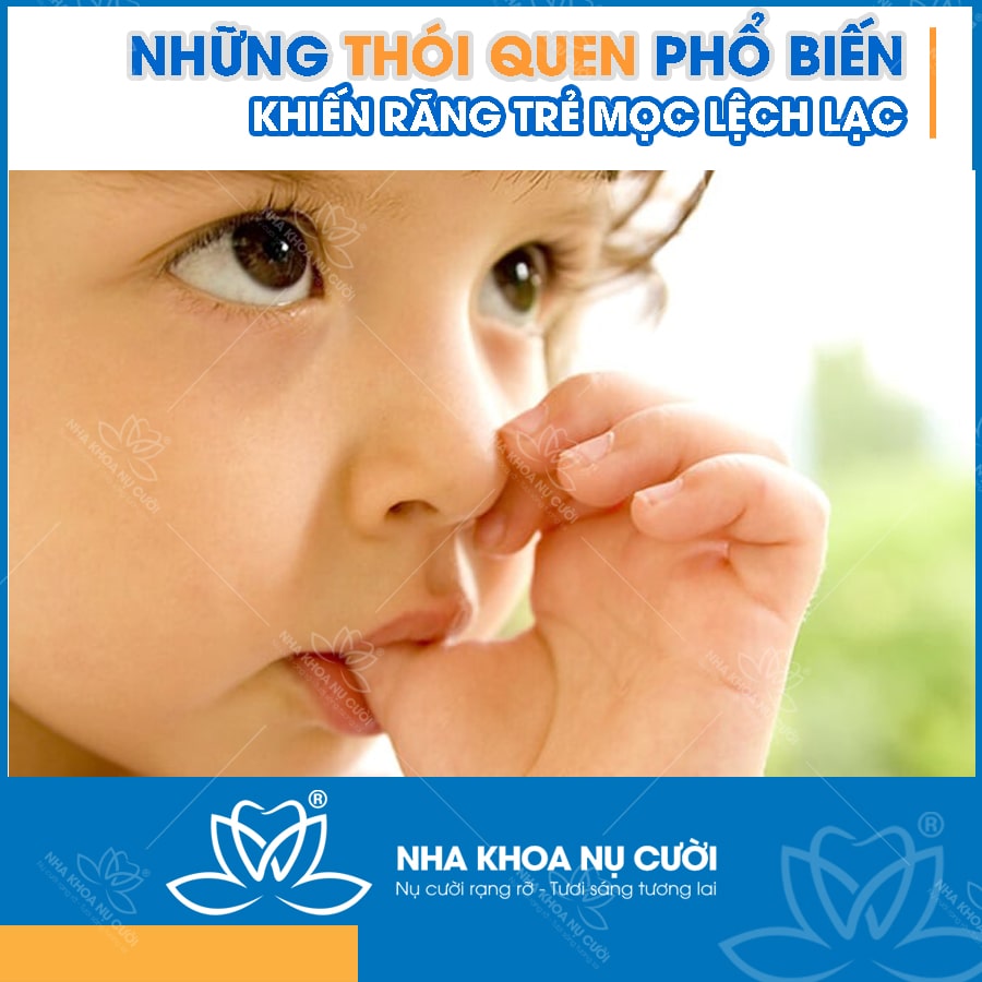 thoi-quen-rang-moc-lech-lac