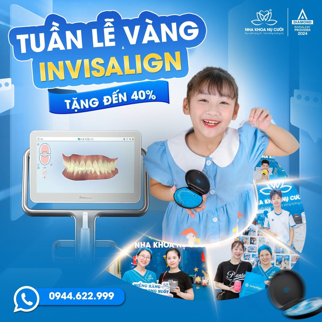 tuan-le-vang-invisalign