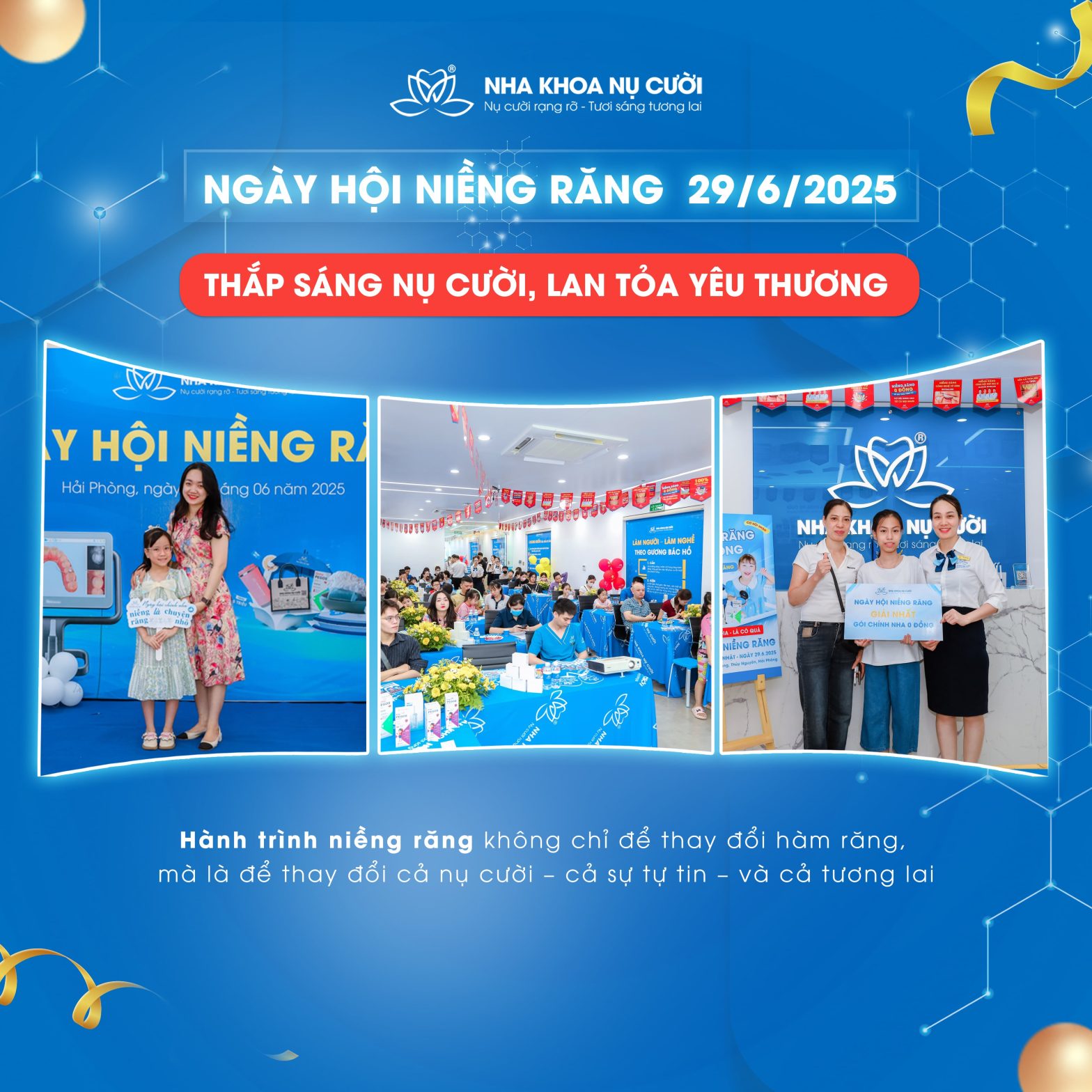 Ngày Hội niềng răng – Thắp sáng nụ cười