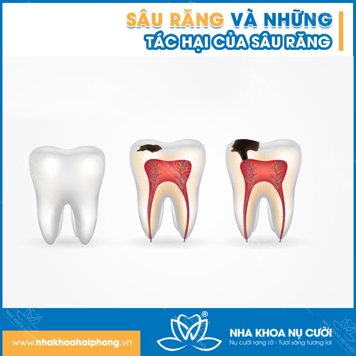 SAU-RANG