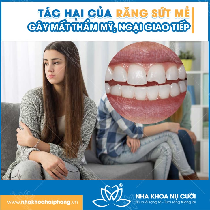 rang-sut-me