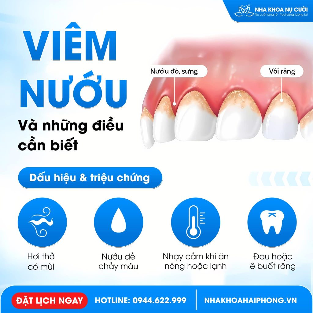viem-nuou