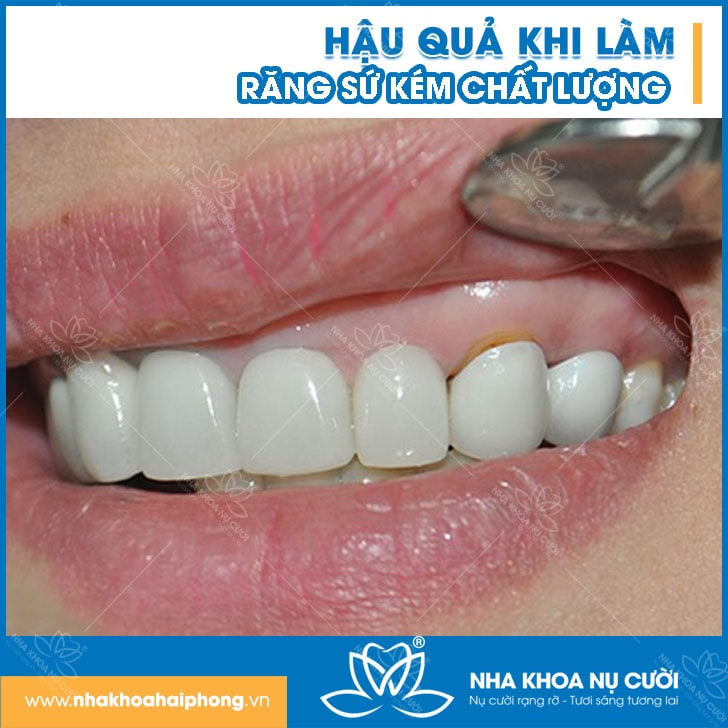 hau-qua
