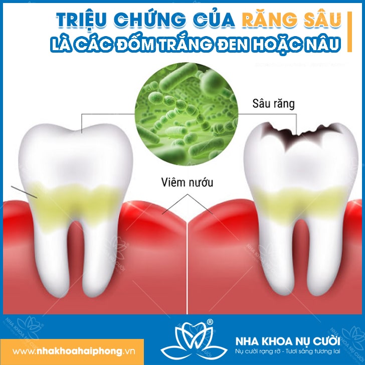 trieu-chung