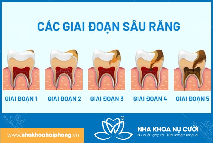 giai-doan