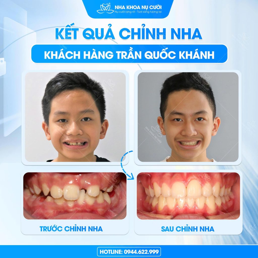 chinh-nha