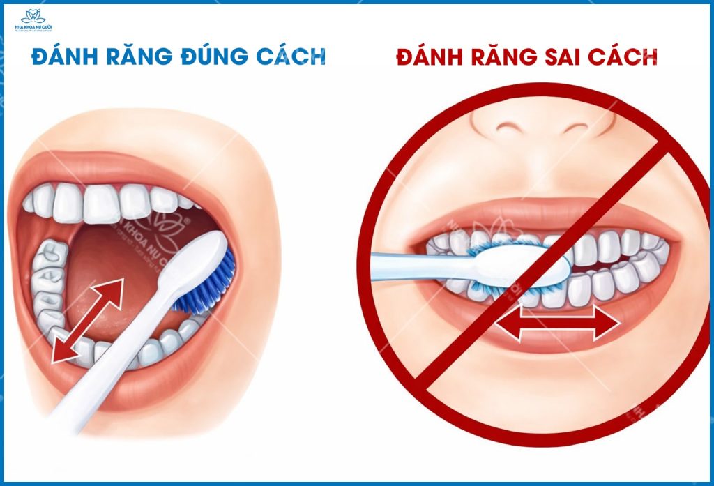 danh-rang