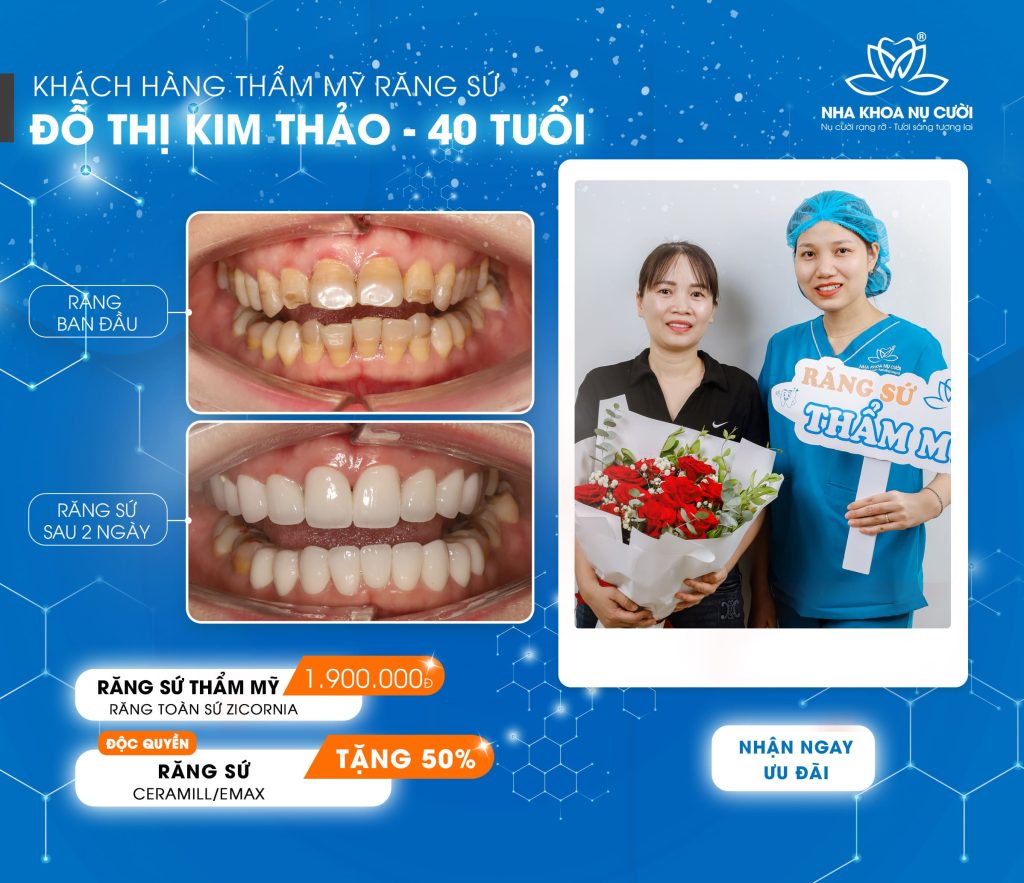 Kim-thao