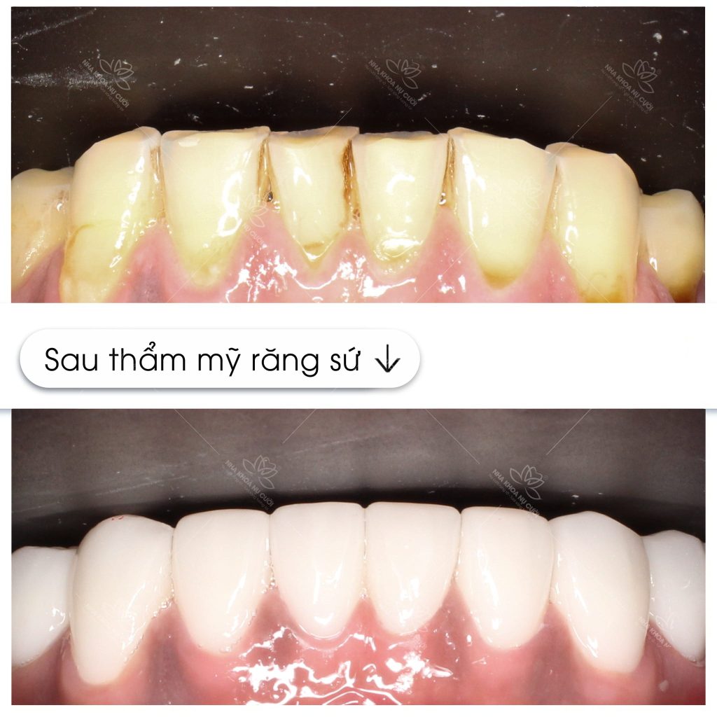 tham-my