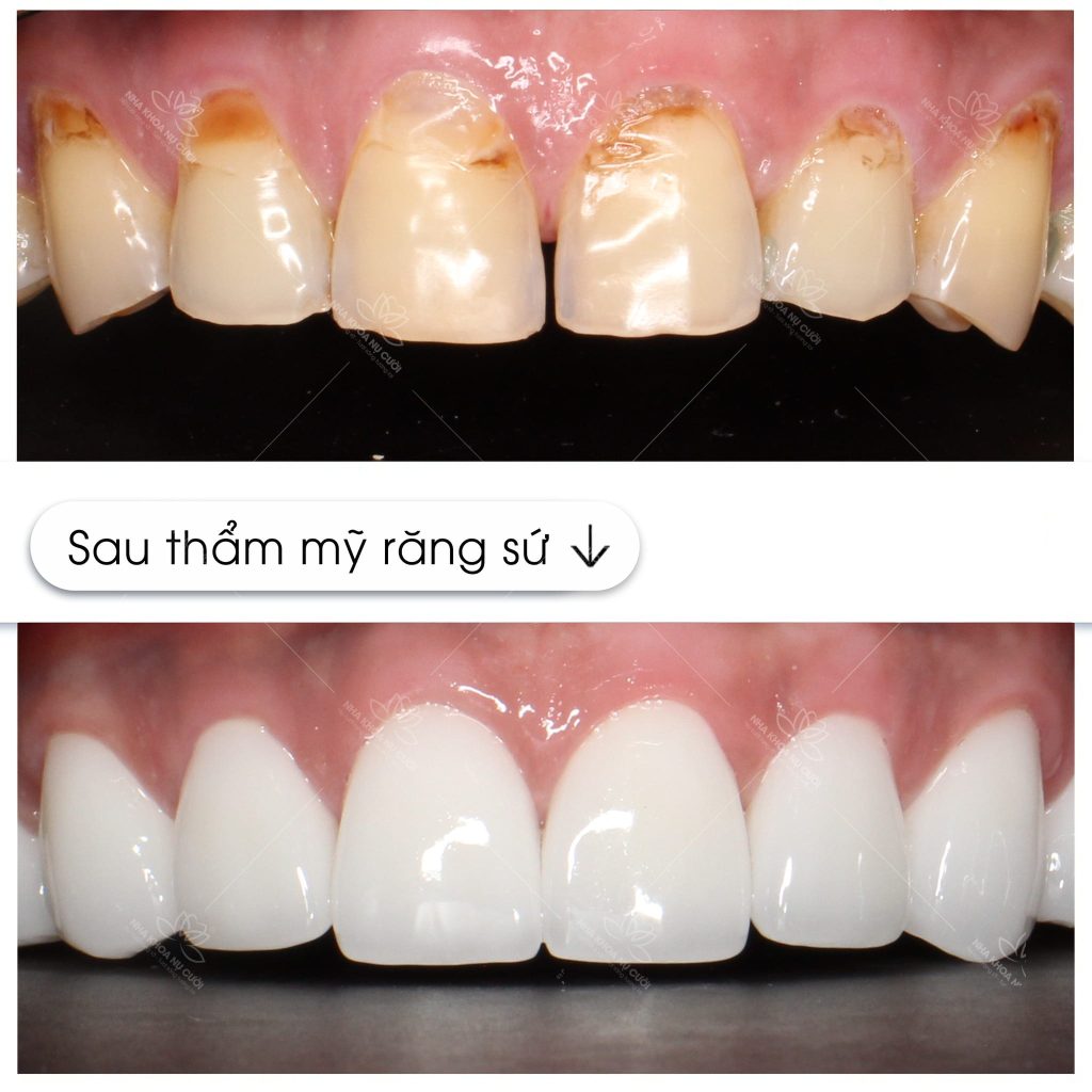 tham-my