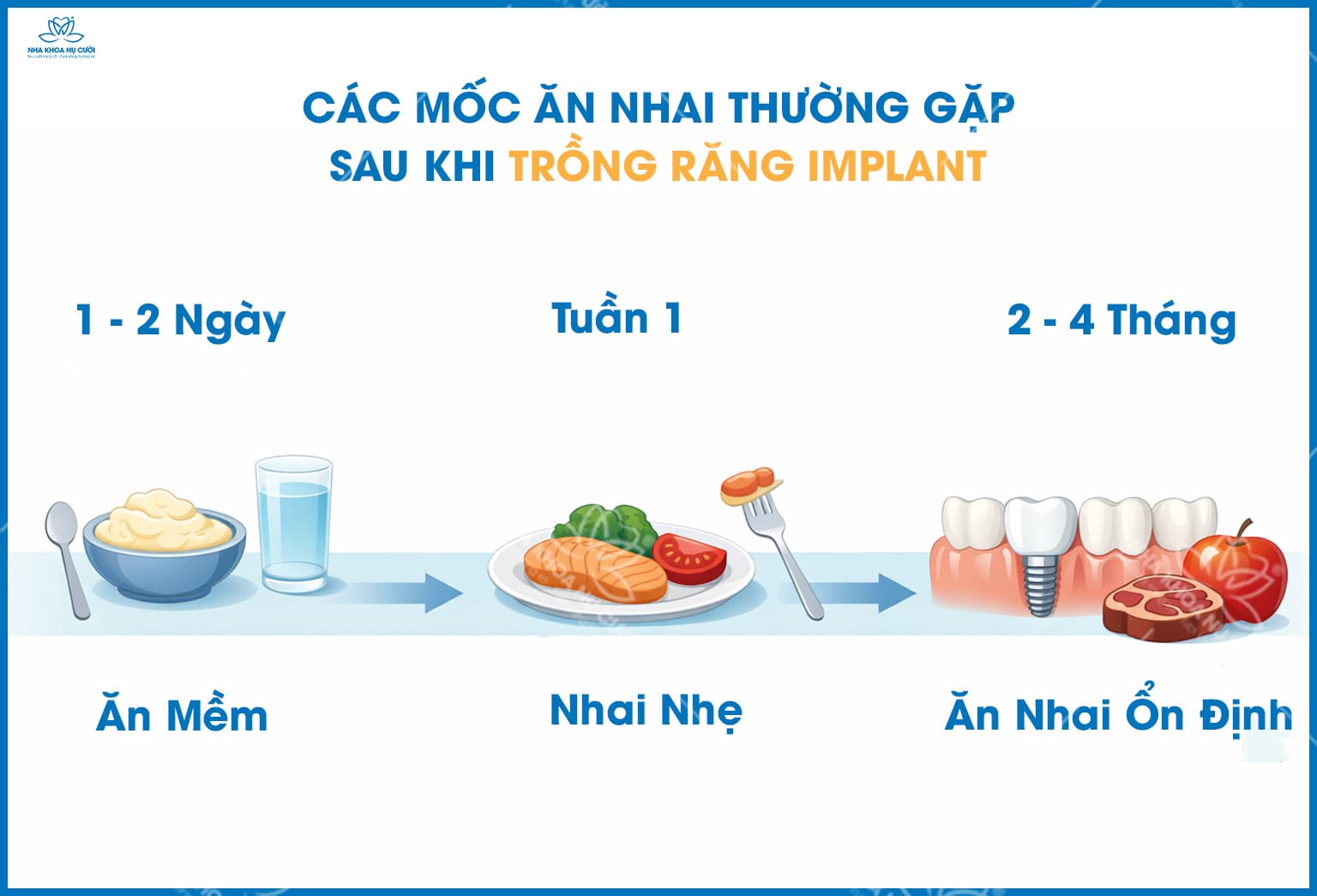 Sau khi trồng Implant bao lâu thì ăn nhai bình thường?