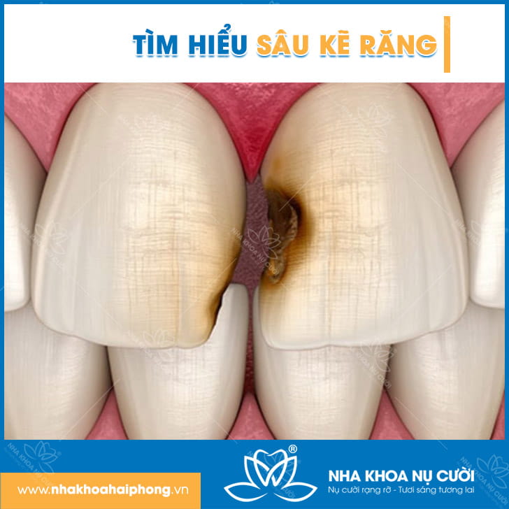 sau-ke-rang