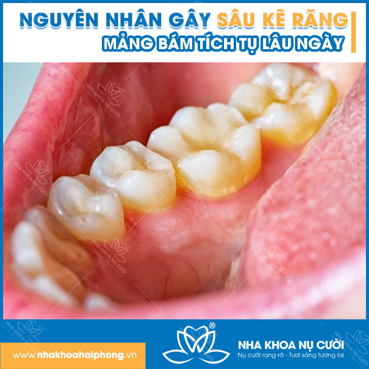 nguyen-nhan