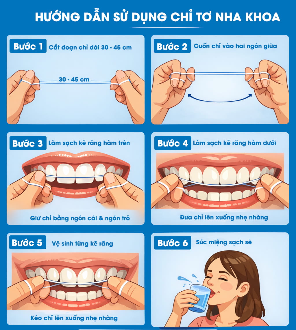 Hướng Dẫn Sử Dụng Chỉ Tơ Nha Khoa Đúng Cách